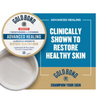 Gold Bond Ointment, Advanced Healing, 7oz Jar